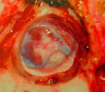  1x 1x80 perforaciya 4