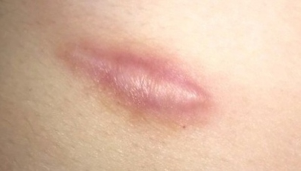 IMG 20190801 190110 1