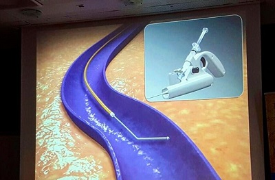 Riga Clarivein