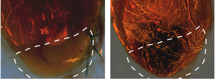 VEGF A modRNA improves heart muscle perfusion after MI