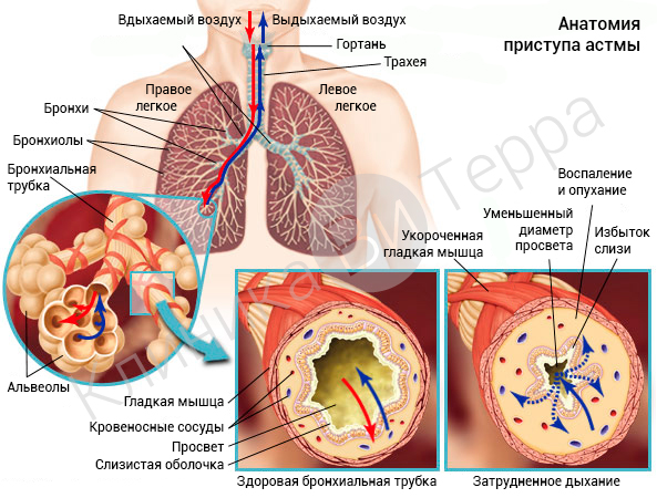 Анатомия бронхиальной астмы