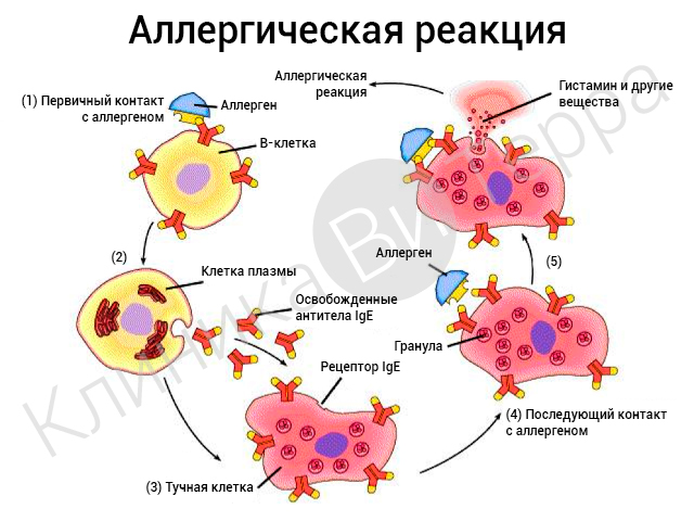 Схема возникновения реакции аллергии на пыль