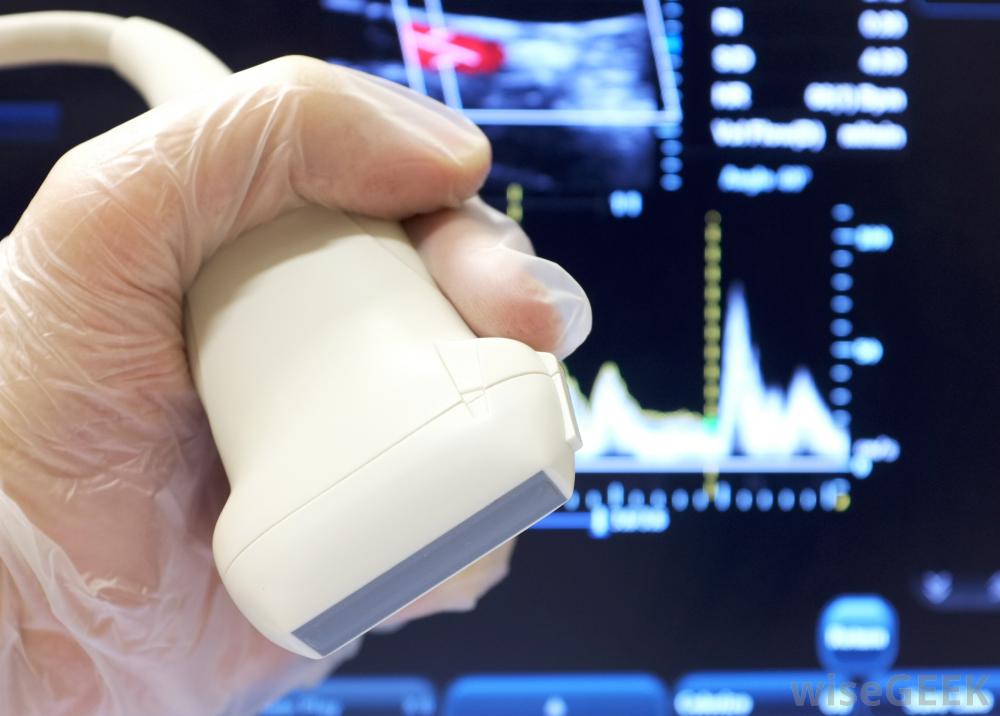 doppler ultrasound with wand