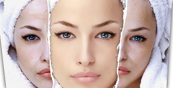 foto do i posle pilinga 700x357