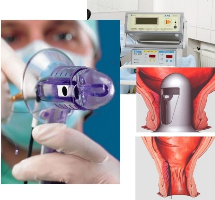 визит к проктологу истории. hal rar. визит к проктологу истории фото. визит к проктологу истории-hal rar. картинка визит к проктологу истории. картинка hal rar. «Случайно сел и теперь — вот. », — так 30-летний мужчина объяснил врачам присутствие овощной культуры в прямой кишке. Но колопроктологов больше интересовали не фантастические соображения пациента, а как извлечь неожиданную находку. визит к проктологу истории. hal rar. визит к проктологу истории фото. визит к проктологу истории-hal rar. картинка визит к проктологу истории. картинка hal rar. «Случайно сел и теперь — вот. », — так 30-летний мужчина объяснил врачам присутствие овощной культуры в прямой кишке. Но колопроктологов больше интересовали не фантастические соображения пациента, а как извлечь неожиданную находку.