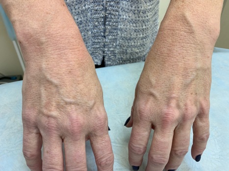 handled IMG 0362 1920 1080 80