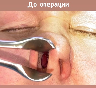 handled IMG 2597 1080 1920 80 2