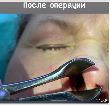 handled IMG 2608 1080 1920 80