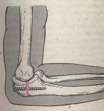 handled IMG 4416 1080 1920 800