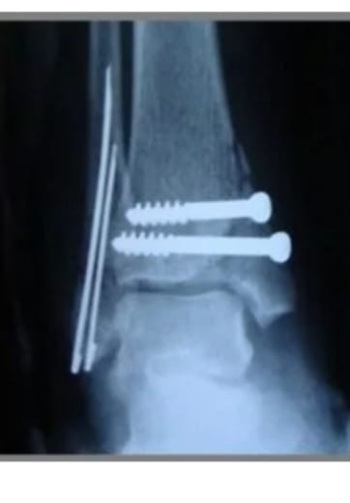 handled PHOTO 2021 03 09 12 54 28 1080 1920 80