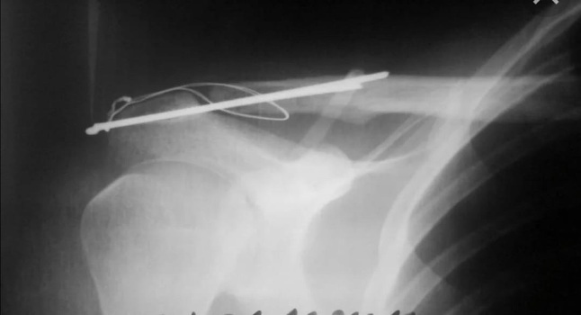 handled PHOTO 2021 03 09 12 54 28 1080 1920 80 3