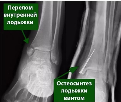 handled PHOTO 2021 03 09 13 00 46 1080 1920 80