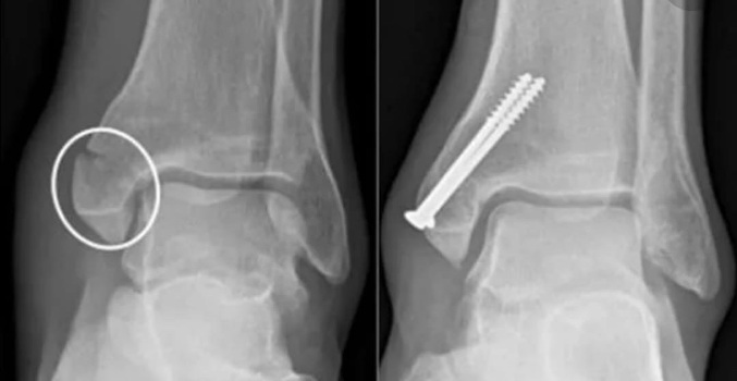 handled PHOTO 2021 03 09 13 01 24 1080 1920 80