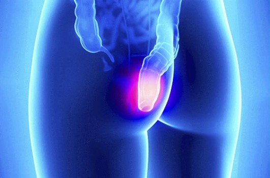 визит к проктологу истории. hemor. визит к проктологу истории фото. визит к проктологу истории-hemor. картинка визит к проктологу истории. картинка hemor. «Случайно сел и теперь — вот. », — так 30-летний мужчина объяснил врачам присутствие овощной культуры в прямой кишке. Но колопроктологов больше интересовали не фантастические соображения пациента, а как извлечь неожиданную находку. визит к проктологу истории. hemor. визит к проктологу истории фото. визит к проктологу истории-hemor. картинка визит к проктологу истории. картинка hemor. «Случайно сел и теперь — вот. », — так 30-летний мужчина объяснил врачам присутствие овощной культуры в прямой кишке. Но колопроктологов больше интересовали не фантастические соображения пациента, а как извлечь неожиданную находку.