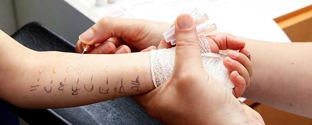 Аллергопробы