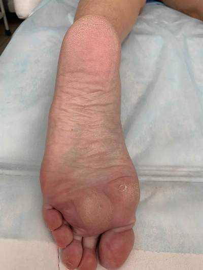 leg 2