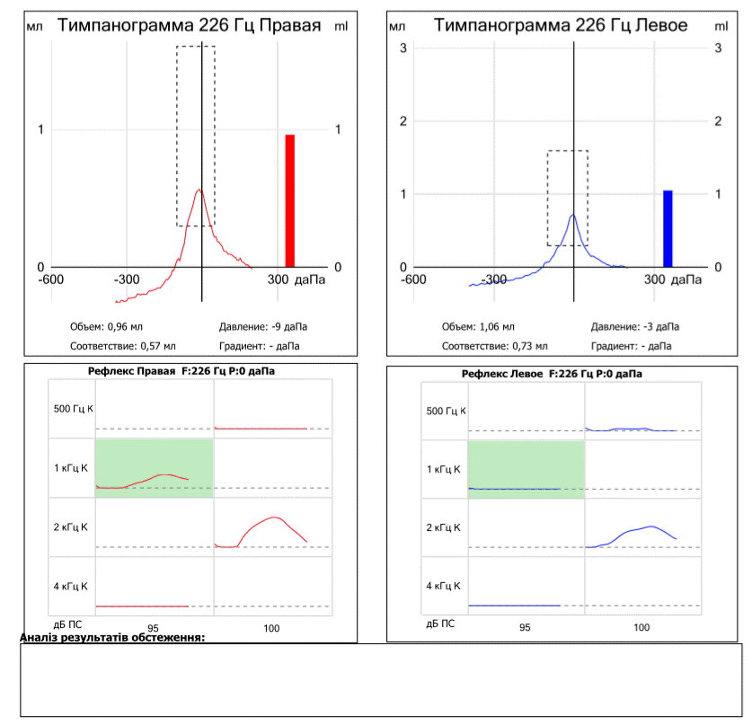 Тимпанометрия что. Тимпанометрия Тип а с обеих сторон что это. Тимпанометрия 226 Гц. Тимпанометрия с исследованием функции слуховой трубы. Тимпанометрия Тип as.