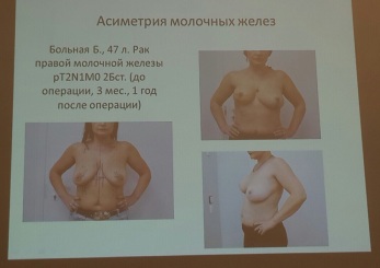 mobile 20161122 142504