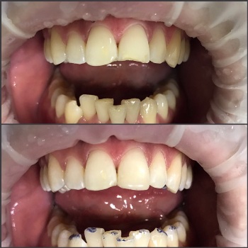 mobile 20170830 203707