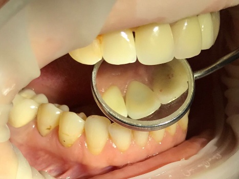 mobile 20170830 204312