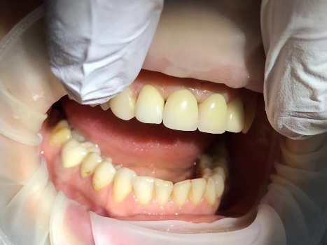 mobile 20170830 204318