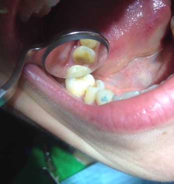 mobile 20170830 204636