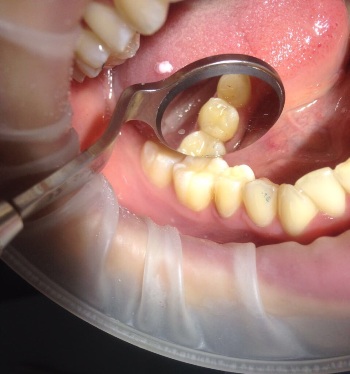 mobile 20170830 204644