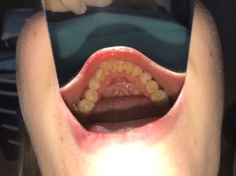 mobile 20170905 234042