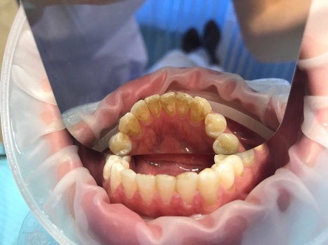 mobile 20170905 234050