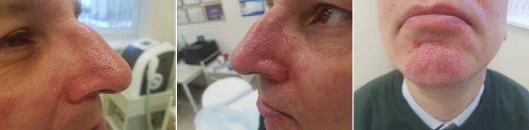 mobile 20190121 173432 32