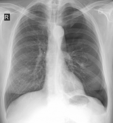 mobile 20190928 212009