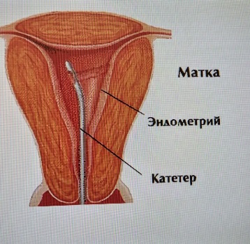 mobile 20200227 092808