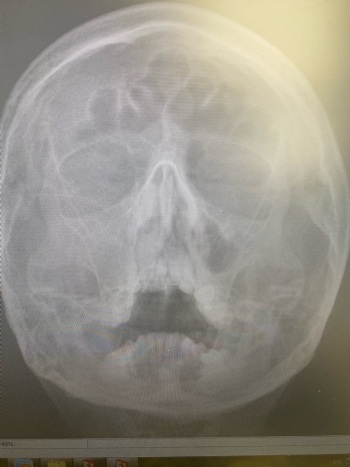 mobile 20200701 095750