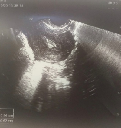 mobile 20201103 134517