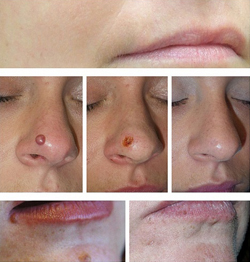 картинка сург