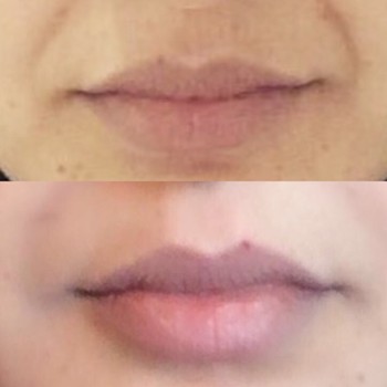 photo lips