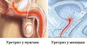 уретро2
