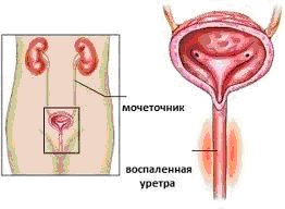 уретро4