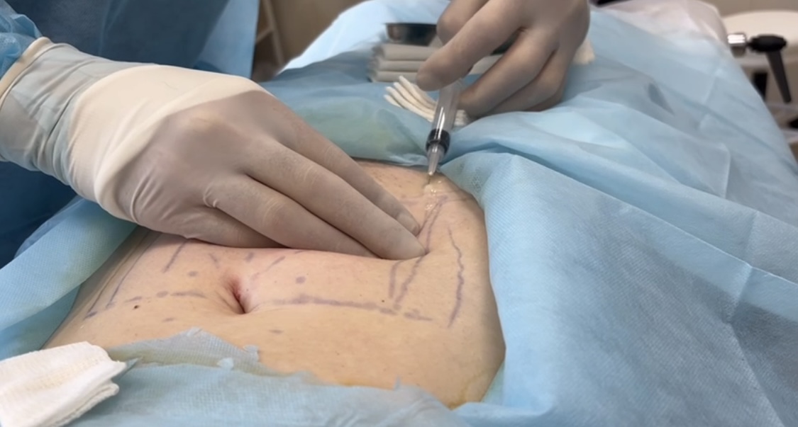 Подготовка SVF