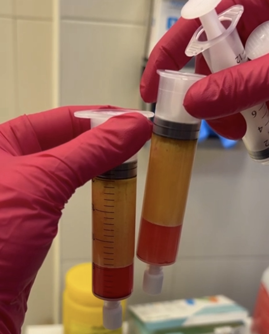 Центрифугирование SVF