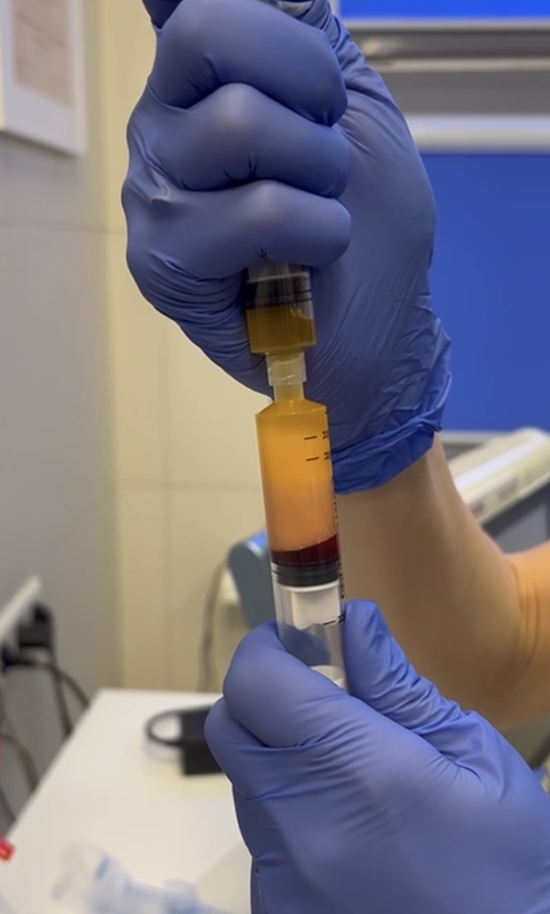 Перенос клеточной фракции