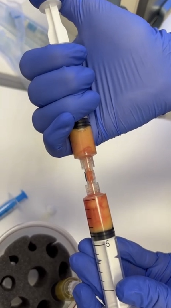 Готовые пробирки Cortexil SVF