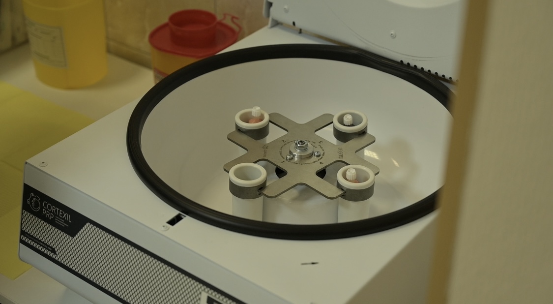 SVF процедура 2