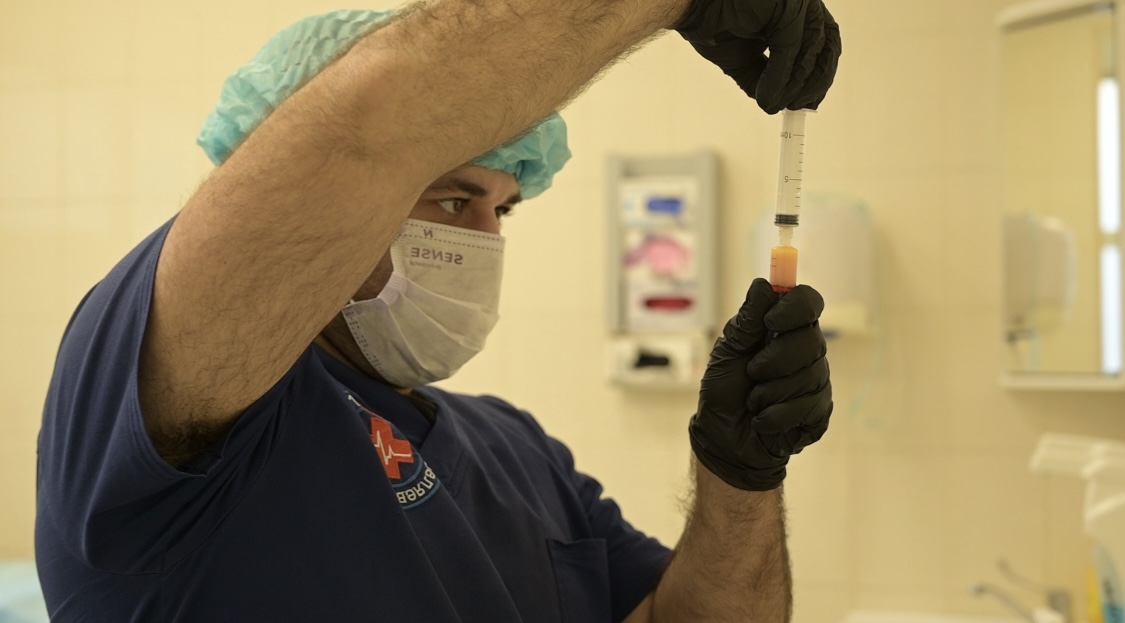 SVF процедура 4