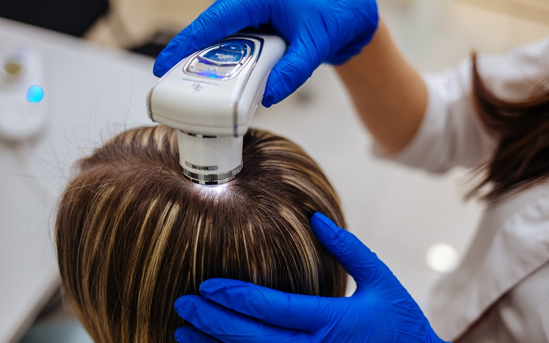 Трихоскопия — диагностика кожи головы