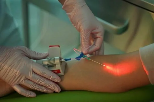 Внутривенное лазерное облучение крови (ВЛОК)