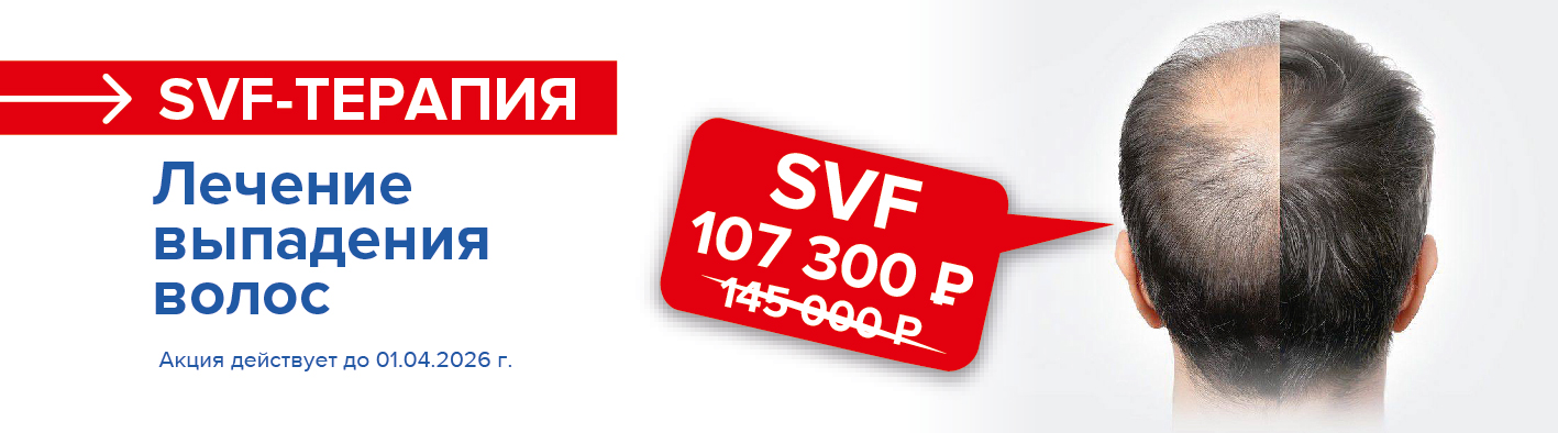 SVF
