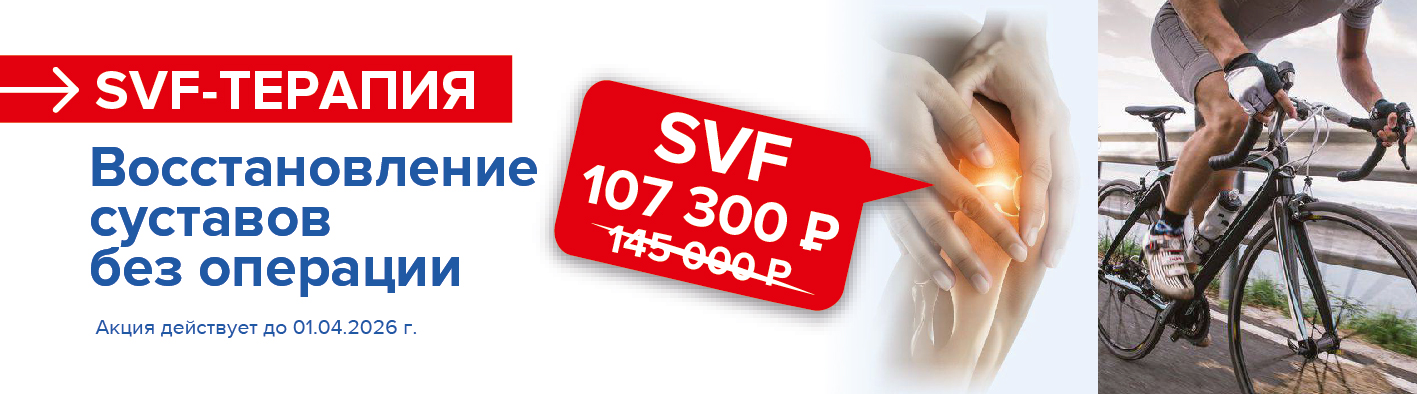 SVF