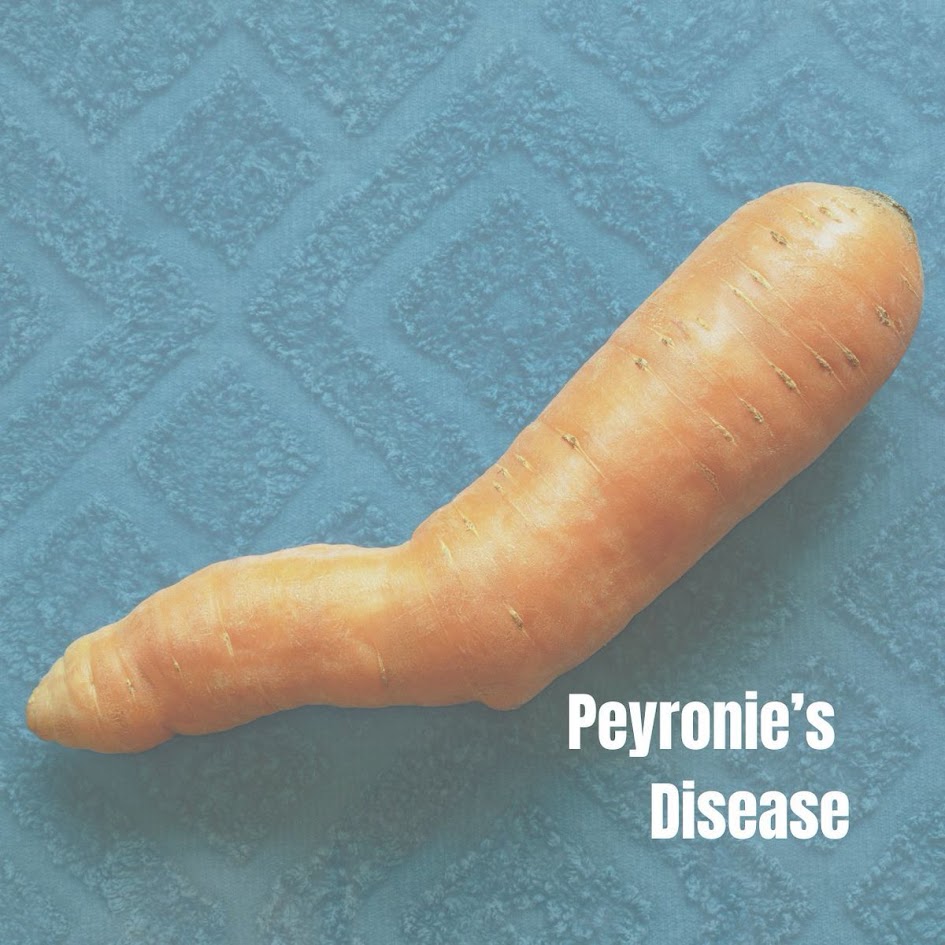 Болезнь Пейрони с положительной динамикой на фоне комбинированной SVF и УВТ-терапии