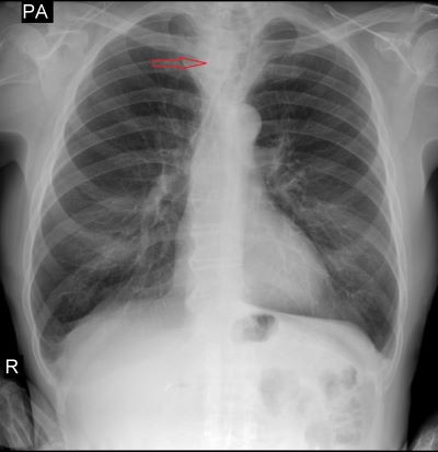 mong1_1.jpg mong1_1.jpg